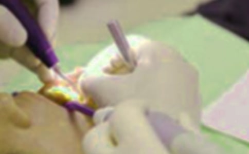 拔牙優(yōu)秀作文15篇(必備)