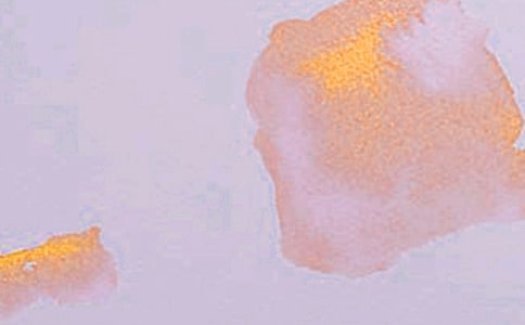 藝術(shù)團(tuán)工作總結(jié)匯編15篇