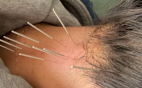 最新針灸科年終工作總結(jié)